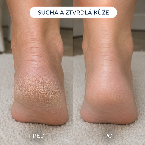 Pativelle Smooth Pro™ – elektrický pilník na paty