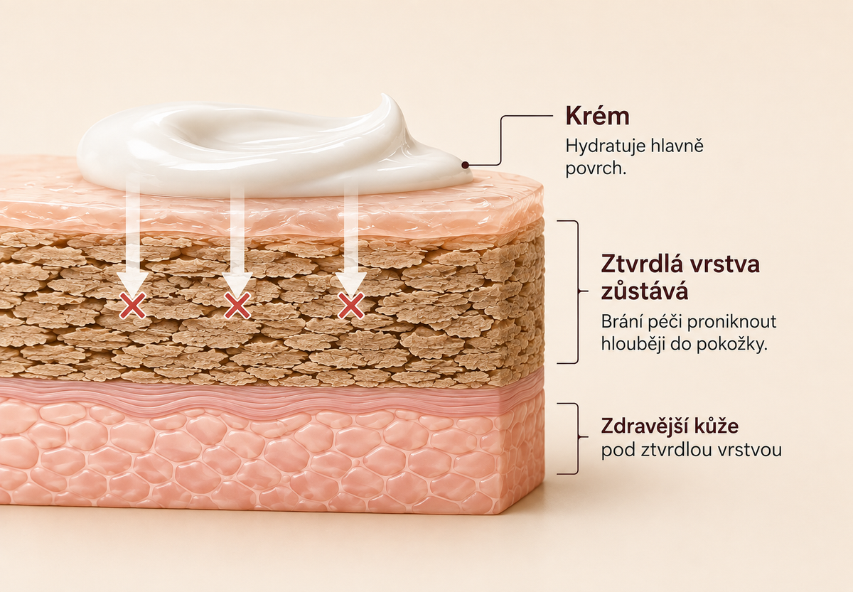 Pativelle Smooth Pro™ – elektrický pilník na paty