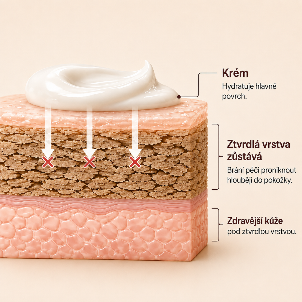 Pativelle Smooth Pro™ – elektrický pilník na paty